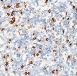 Plasma Cell Antibody in Immunohistochemistry (Paraffin) (IHC (P))
