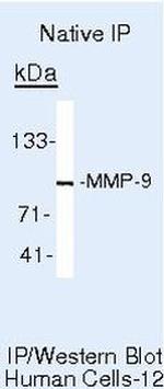 MMP9 Antibody in Immunoprecipitation (IP)