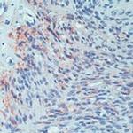 CD171 Antibody in Immunohistochemistry (Paraffin) (IHC (P))
