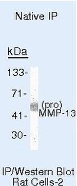 MMP13 Antibody in Immunoprecipitation (IP)