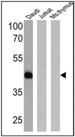 CD38 Antibody in Western Blot (WB)