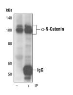 alpha N-Catenin Antibody in Immunoprecipitation (IP)