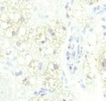 ATGL Antibody in Immunohistochemistry (Paraffin) (IHC (P))
