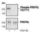 Phospho-PDGFRB (Tyr771) Antibody in Western Blot (WB)