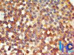 TLR6 Antibody in Immunohistochemistry (Paraffin) (IHC (P))