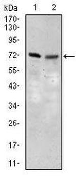 SLC27A5 Antibody in Western Blot (WB)