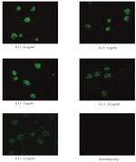 Podoplanin Antibody in Immunohistochemistry (Frozen) (IHC (F))