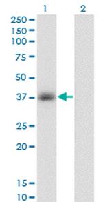 GPD1 Antibody in Western Blot (WB)