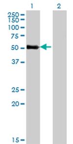 ZNF232 Antibody in Western Blot (WB)