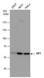 ME1 Antibody in Western Blot (WB)
