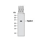 Trypsin 2 Antibody in Western Blot (WB)
