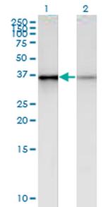 PHC2 Antibody in Western Blot (WB)