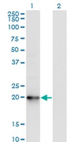 COMMD1 Antibody in Western Blot (WB)