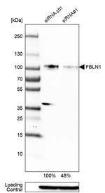 Fibulin 1 Antibody in Western Blot (WB)