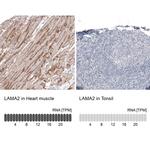 Laminin alpha-2 Antibody in Immunohistochemistry (IHC)