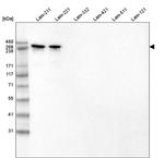 Laminin alpha-2 Antibody in Western Blot (WB)