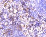 HAPLN1 Antibody in Immunohistochemistry (Paraffin) (IHC (P))