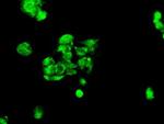 Kindlin 2 Antibody in Immunocytochemistry (ICC/IF)