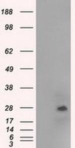 NAT8 Antibody in Western Blot (WB)