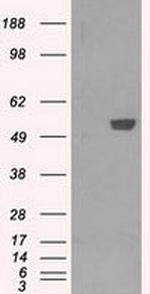 PFKFB4 Antibody in Western Blot (WB)