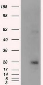 KCTD5 Antibody in Western Blot (WB)