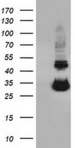UCK1 Antibody in Western Blot (WB)