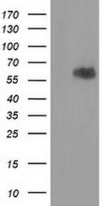 EXD1 Antibody in Western Blot (WB)