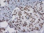 CTDSP1 Antibody in Immunohistochemistry (Paraffin) (IHC (P))