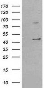 SERPINB3 Antibody in Western Blot (WB)
