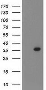 PIH1D2 Antibody in Western Blot (WB)