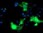 PDLIM2 Antibody in Immunocytochemistry (ICC/IF)