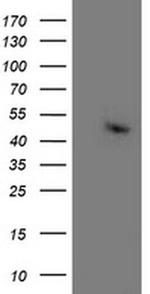 Aminoacylase Antibody in Western Blot (WB)