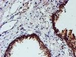 NUBPL Antibody in Immunohistochemistry (Paraffin) (IHC (P))