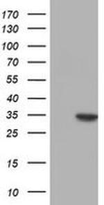 NUBPL Antibody in Western Blot (WB)