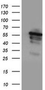 CYP2A6 Antibody in Western Blot (WB)