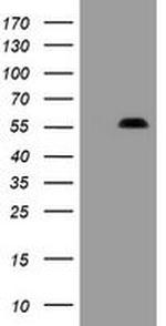 PHF7 Antibody in Western Blot (WB)