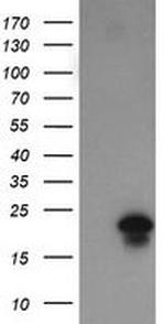 FATE1 Antibody in Western Blot (WB)
