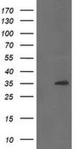 CGI-62 Antibody in Western Blot (WB)