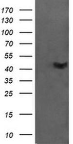 CATIP Antibody in Western Blot (WB)