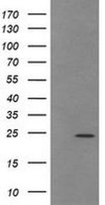 TRAPPC4 Antibody in Western Blot (WB)