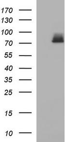 HSD17B4 Antibody in Western Blot (WB)