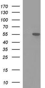 MINPP1 Antibody in Western Blot (WB)