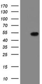 LANCL2 Antibody in Western Blot (WB)