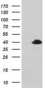 MAGEB1 Antibody in Western Blot (WB)
