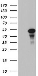 CDCA7L Antibody in Western Blot (WB)