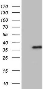 Aspartoacylase Antibody in Western Blot (WB)