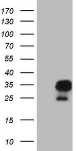 AMTN Antibody in Western Blot (WB)