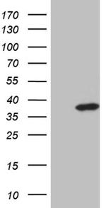 ZMAT4 Antibody in Western Blot (WB)