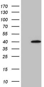 SULT1A3 Antibody in Western Blot (WB)