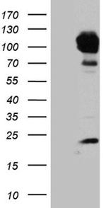 PYGM Antibody in Western Blot (WB)